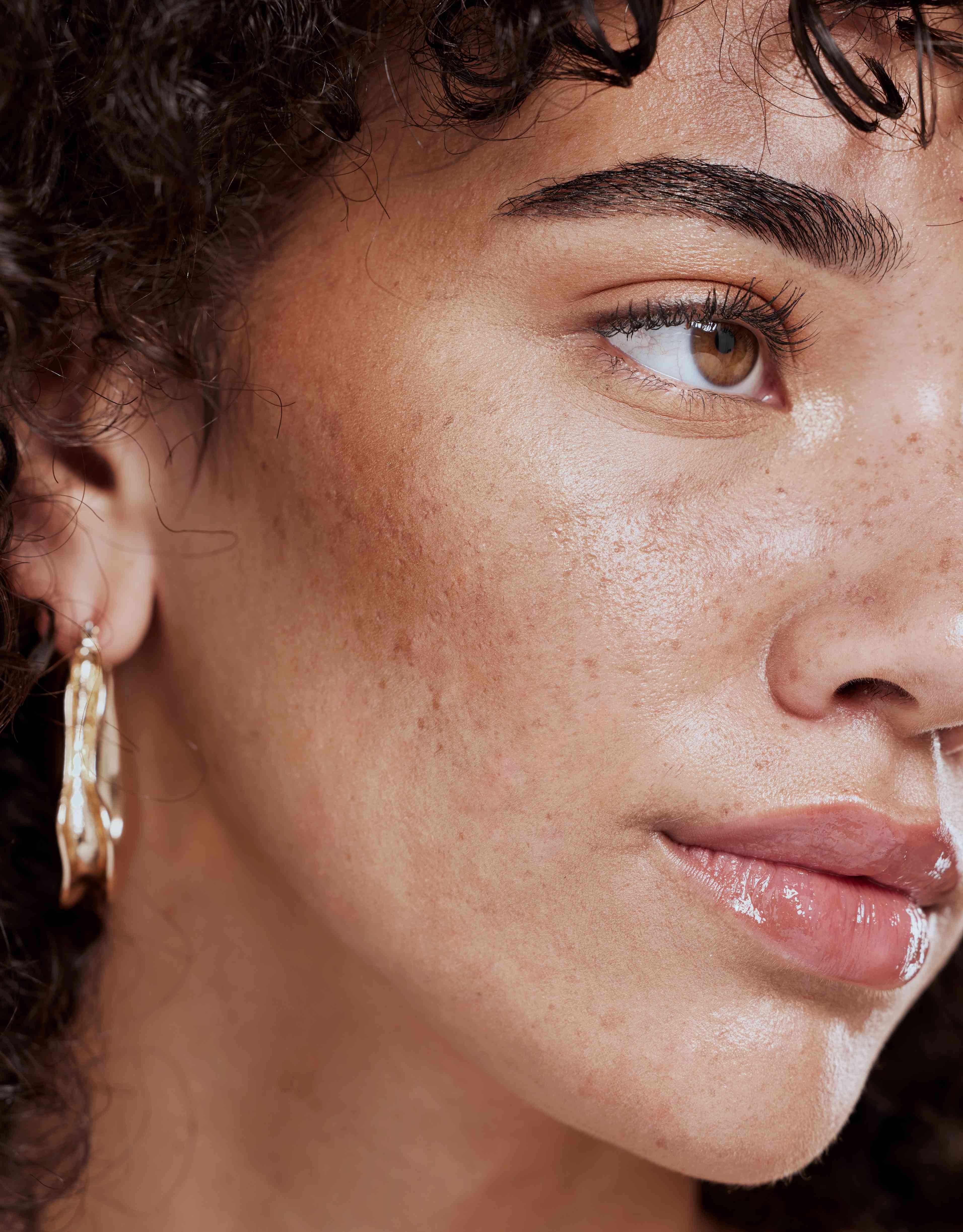 Oily Skin